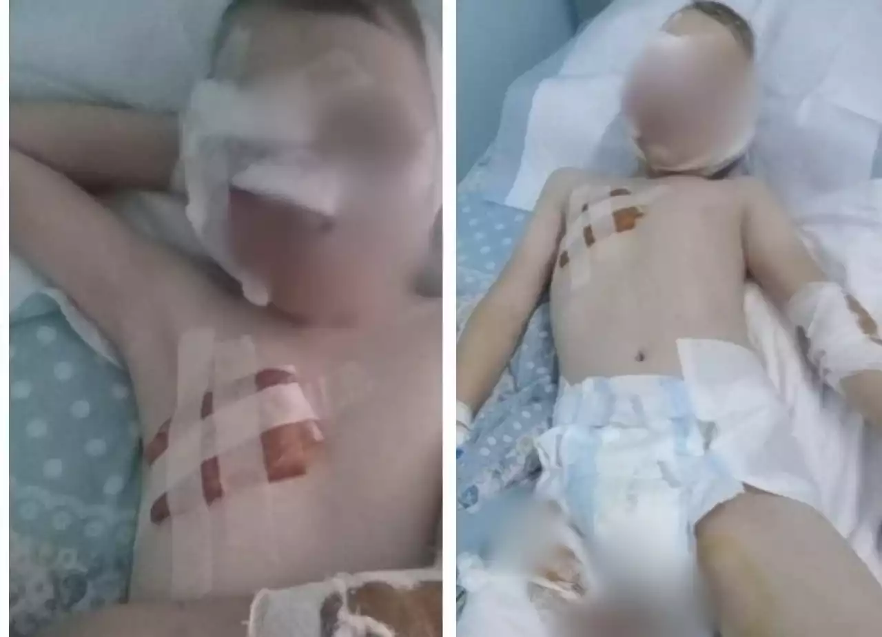 Алматы облысында ит талаған 10 жасар баланың жағдайы белгілі болды