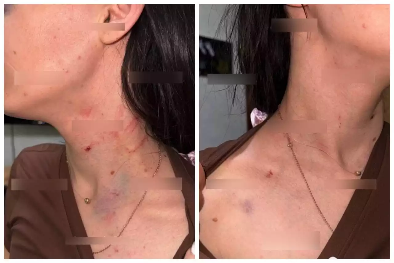 Астанада 25 жастағы қызды өзімен бірге тұрған жігіті мен оның анасы ұрып-соққан