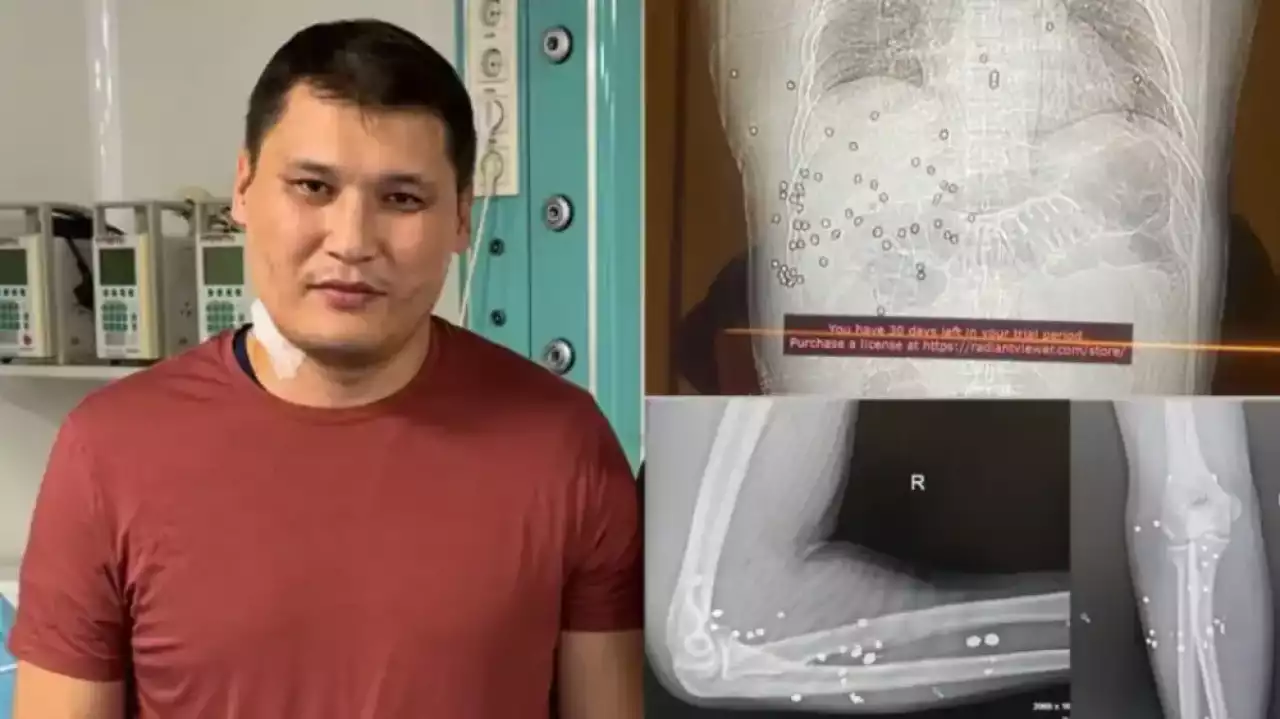 Руслан Берденовке екінші ота жасалмақ