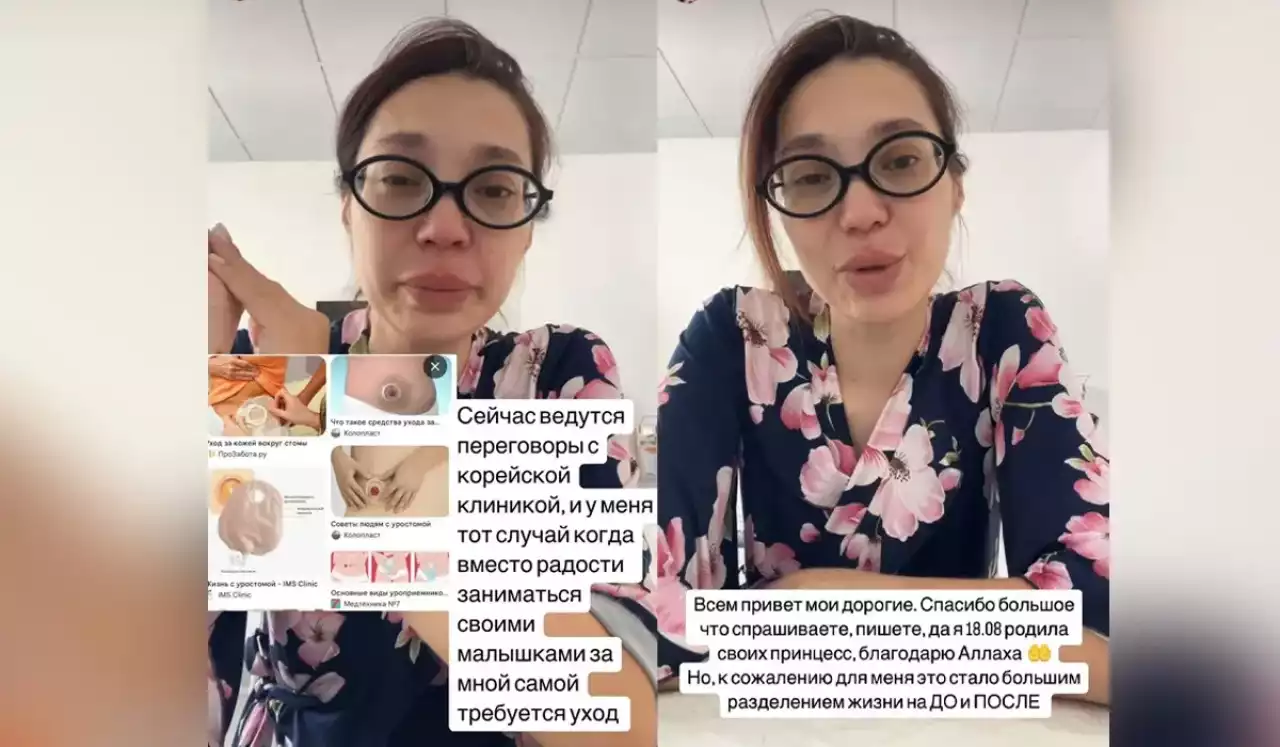 «Жатыр мен қуық бірігіп кеткен»: кесір тілігімен босанған әйел дәрігерлердің салғырттығынан мүгедекке айналған