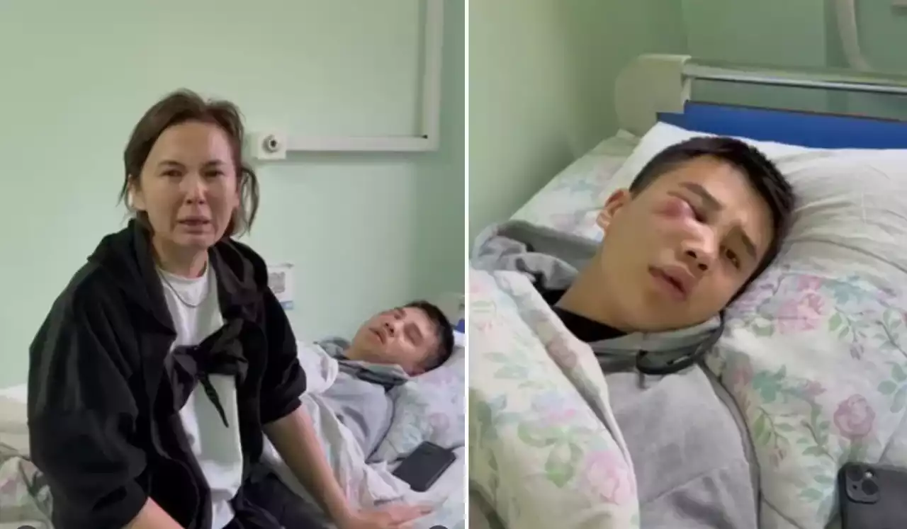 «Мұрнын сындырып, ернін жыртқан»: Алматыда 18 жастағы жігітті бірнеше ер адам жабылып ұрған (ВИДЕО)
