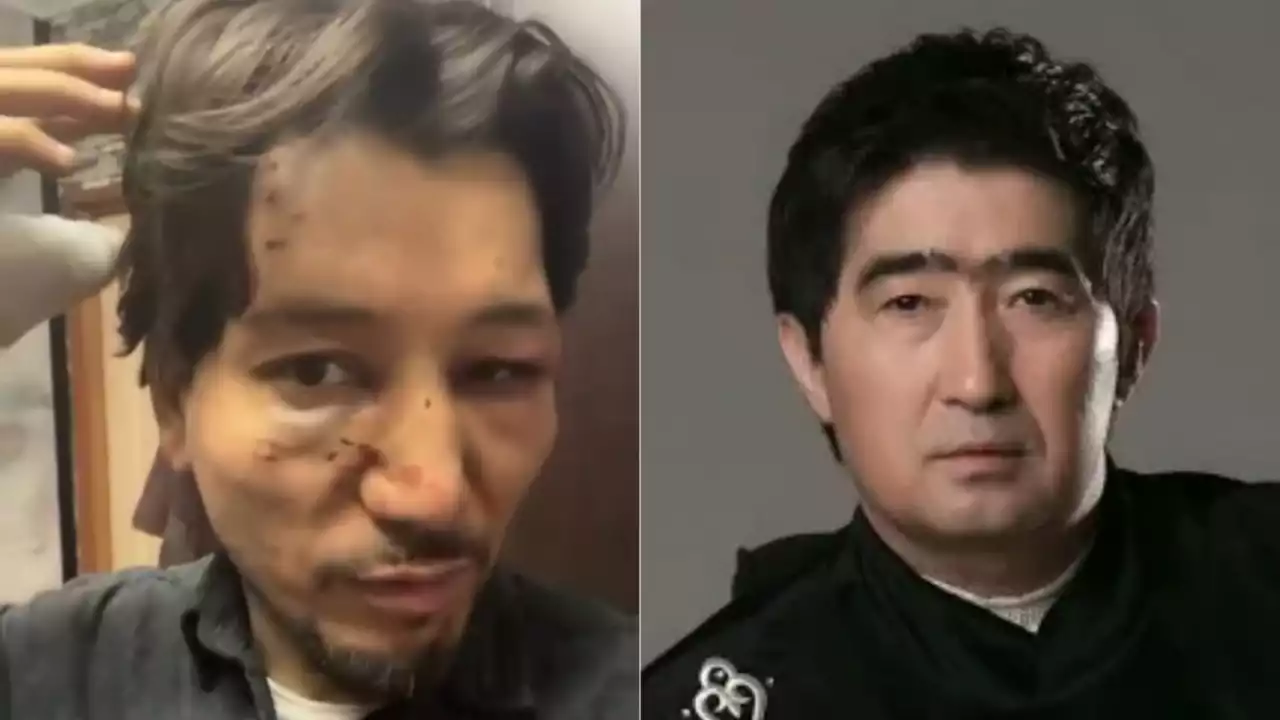 Әнші өзін Мұқасан Шахзадаевтың соққыға жыққанын мәлімдеді: қылмыстық іс қозғалды