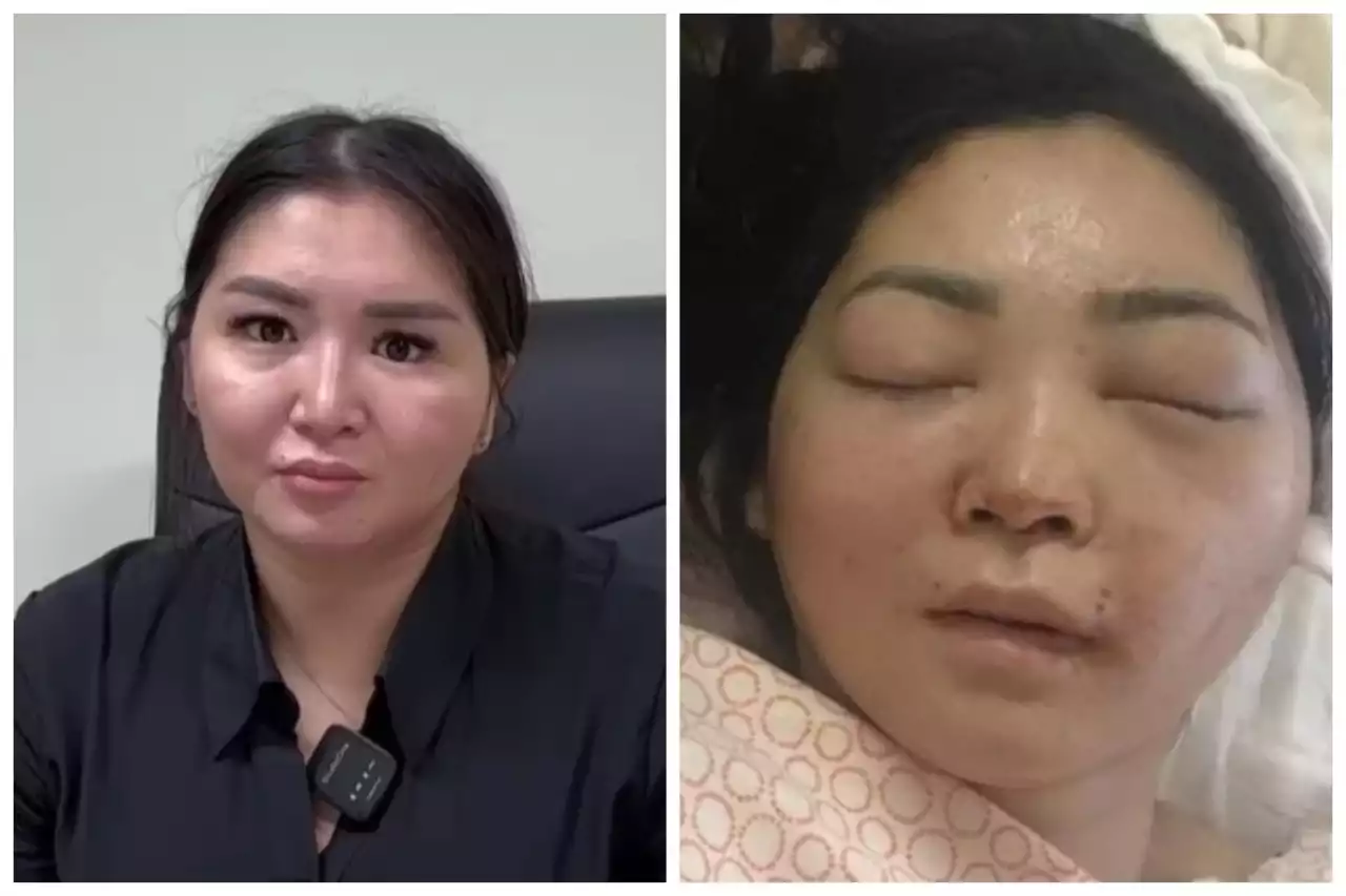 «Бұл әділетсіз шешім»: күйеуінің соққысынан мүгедек болып қалған әйел сотталушының қоныс-колонияға ауыстырылғанына наразы