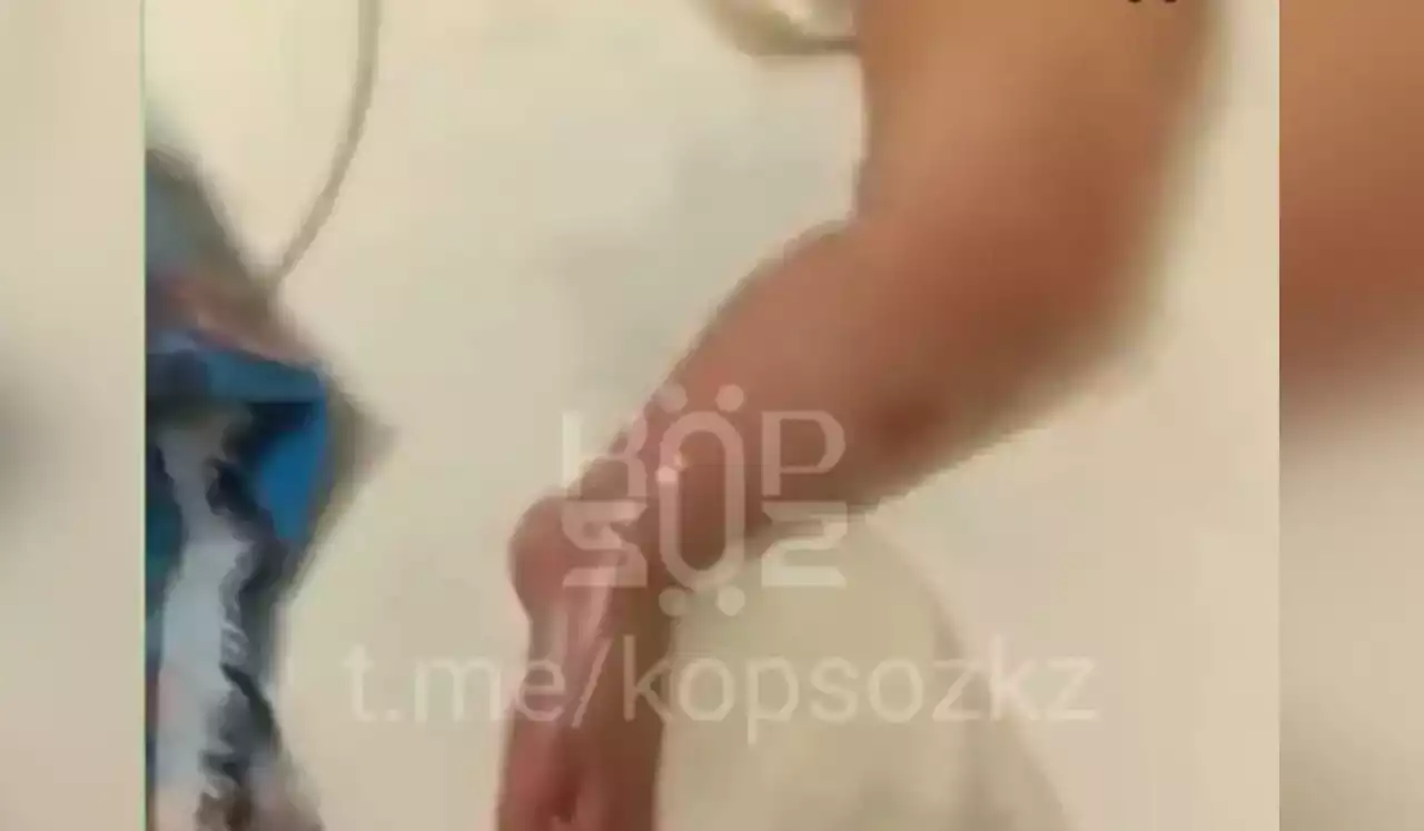 Астанада ауруханада 9 айлық сәби күйік алған (ВИДЕО)