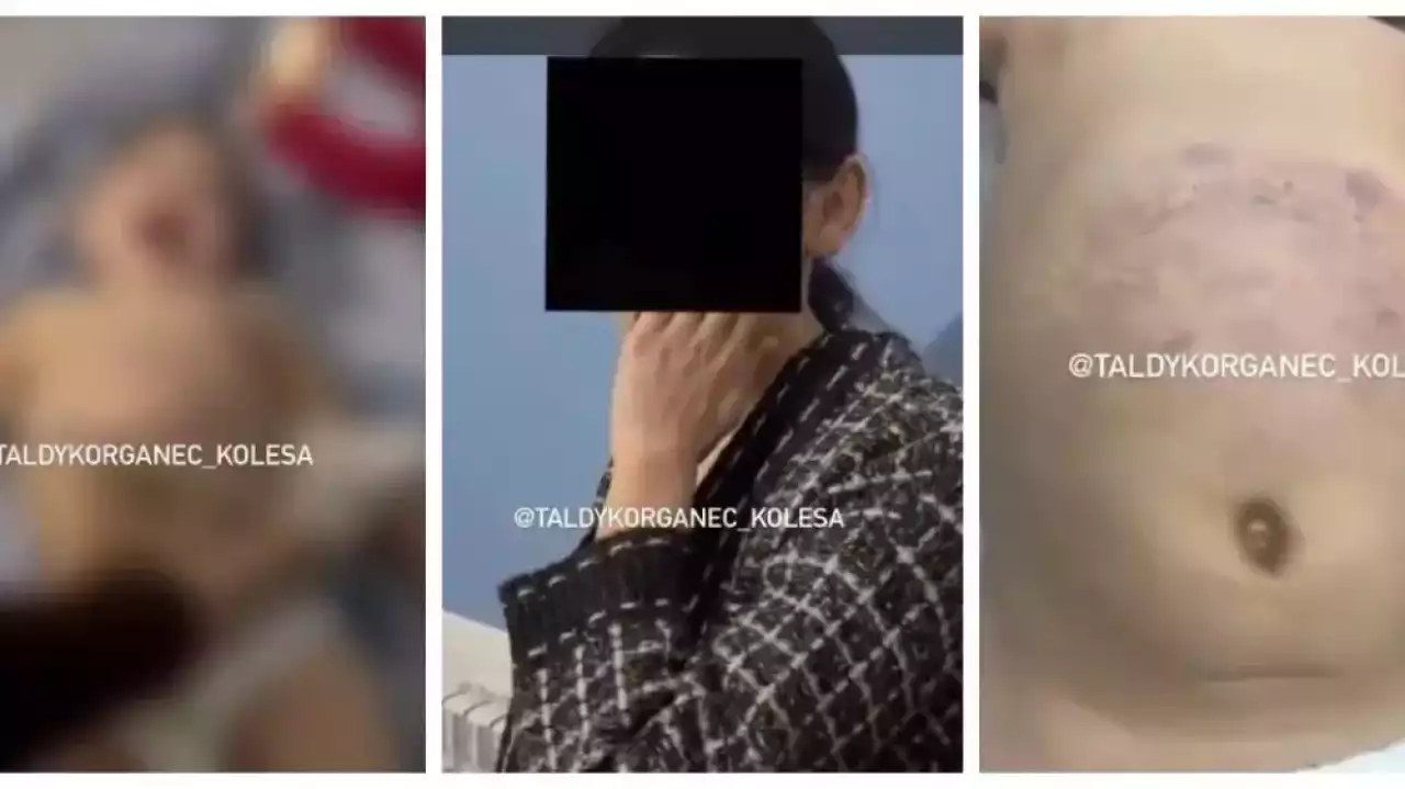 Талдықорғанда ер адам әйелі мен үш жасар қызын сабап тастады: бала жансақтау бөлімінде жатыр (ВИДЕО)