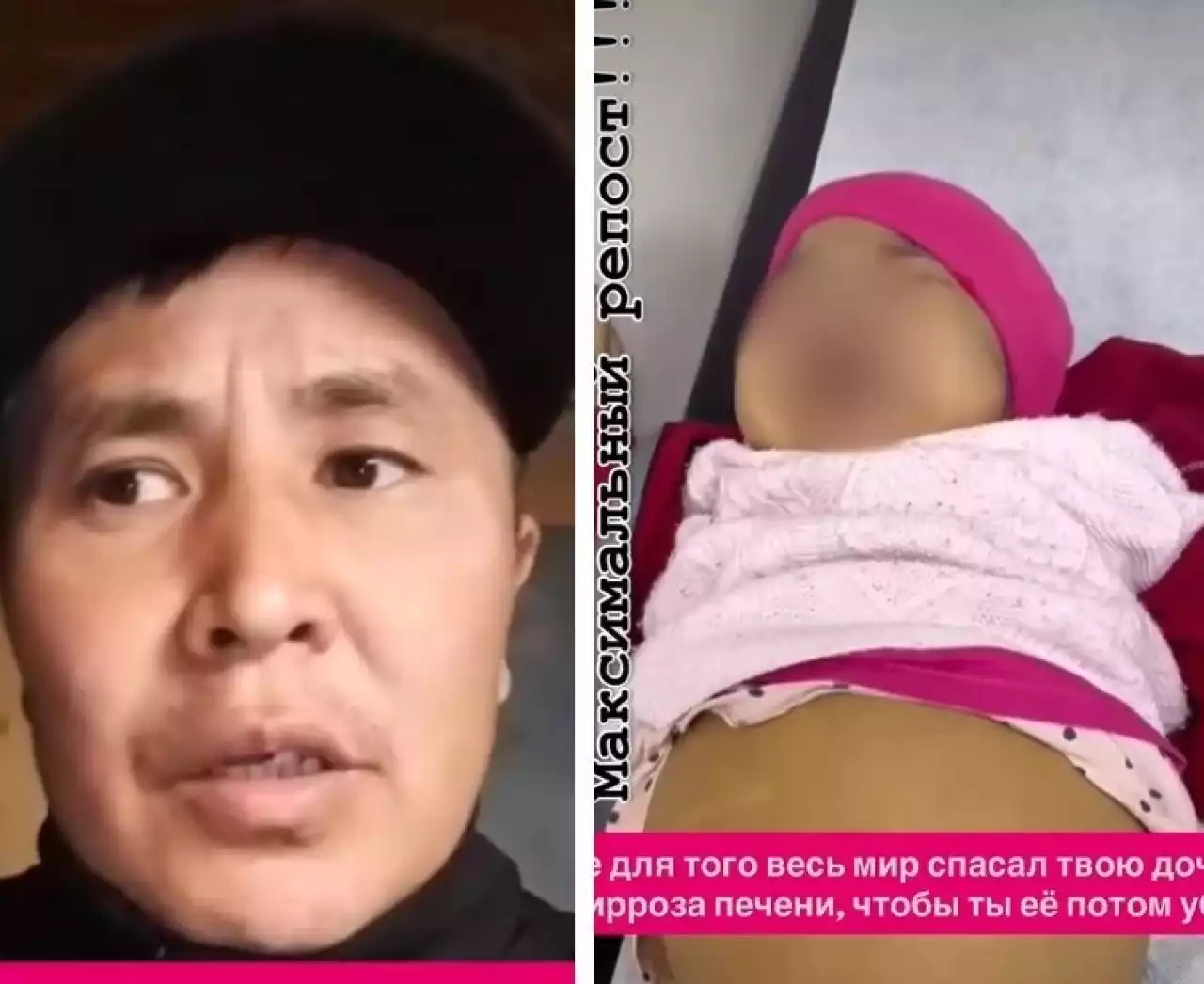 «Бүкіл әлем, оны сен өлтірсін деп құтқармады»: Талдықорғанда әкесі ұрған үш жасар қызға бұрын бауыр трансплантациясы жасалған