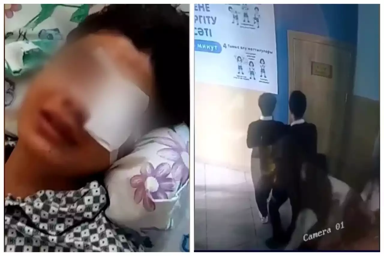 Есін жоғалтқан: Таразда оқушы төбелестен кейін бір көзінен айырылды