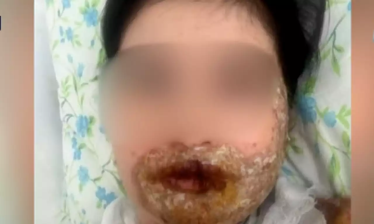 Шымкентте бұрынғы әйелінің үстіне сұйықтық шашып, денесін күйдірген ер адам Алматыда ұсталды